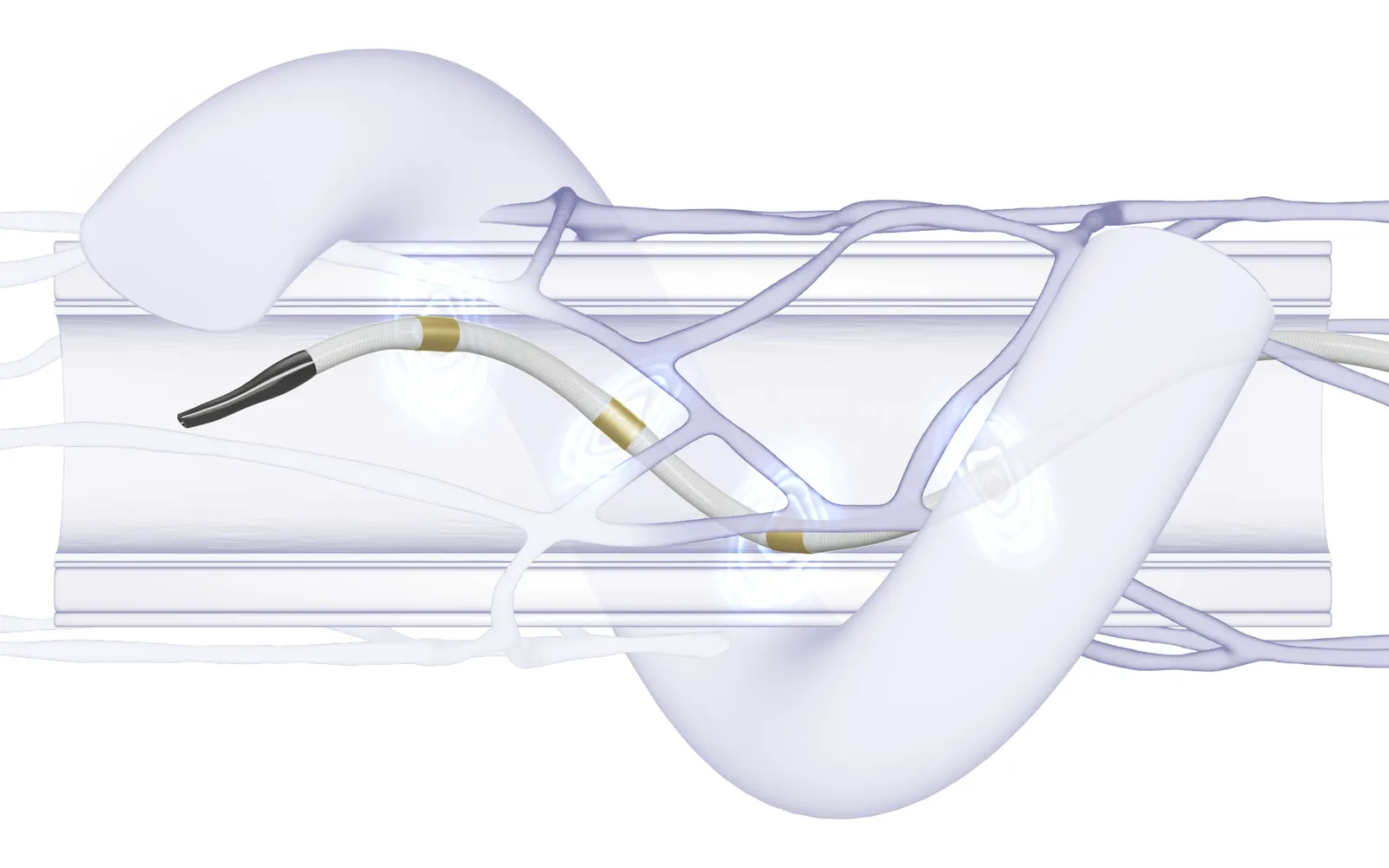 A coil-shaped device is shown moving through a tube with branching structures around it.